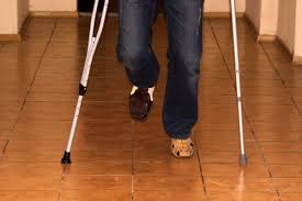 Cómo calcular secuelas físicas y funcionales tras un accidente: guía práctica paso a paso